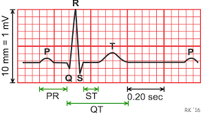ECG Recognition Project